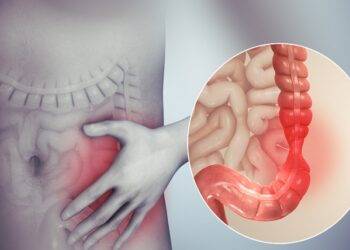 What is the Full Form of IBS? What Are the Symptoms of IBS