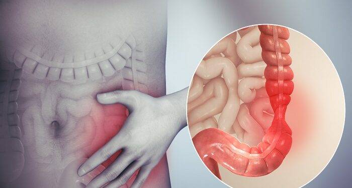 What is the Full Form of IBS? What Are the Symptoms of IBS