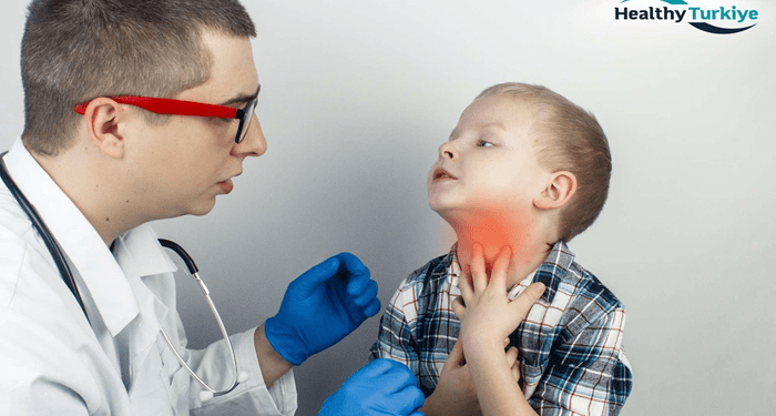 Tonsillectomy for Children in Turkey: Ensuring Safe and Effective Treatment